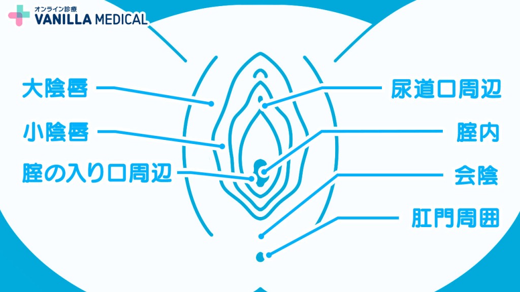 できやすい部位を確認する