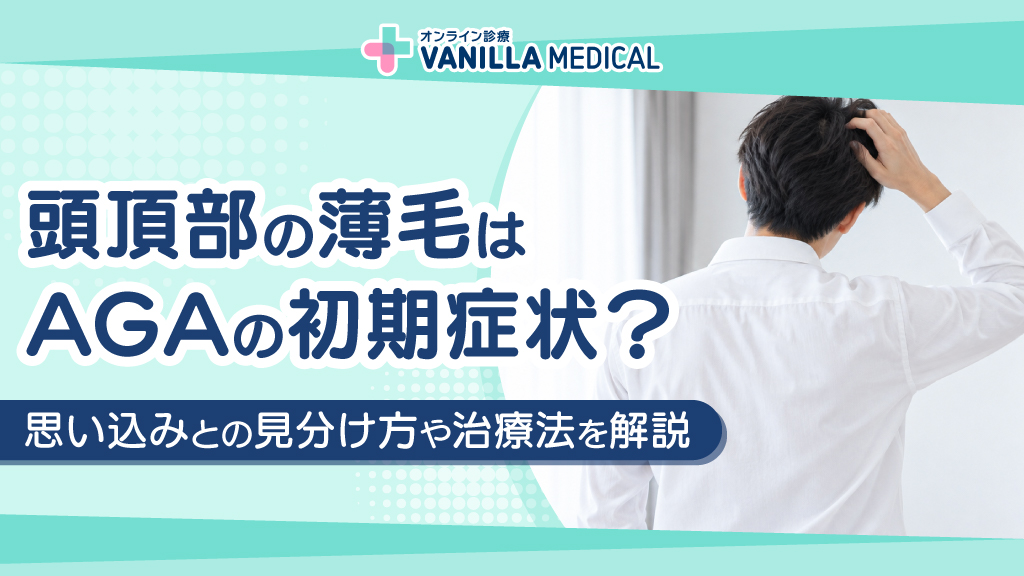 頭頂部の薄毛はAGAの初期症状？思い込みとの見分け方や治療法を解説