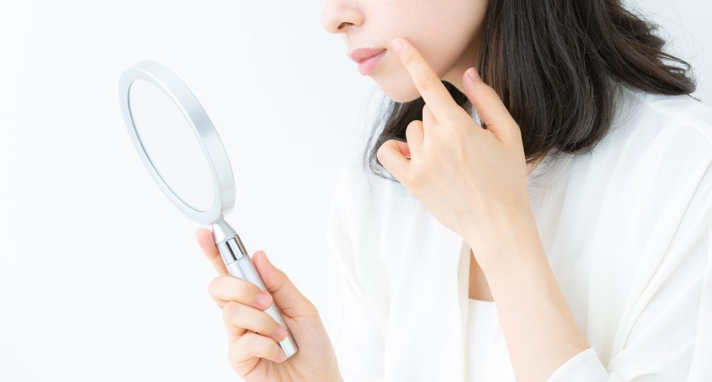 ニキビは種類に応じたケアで早期改善を