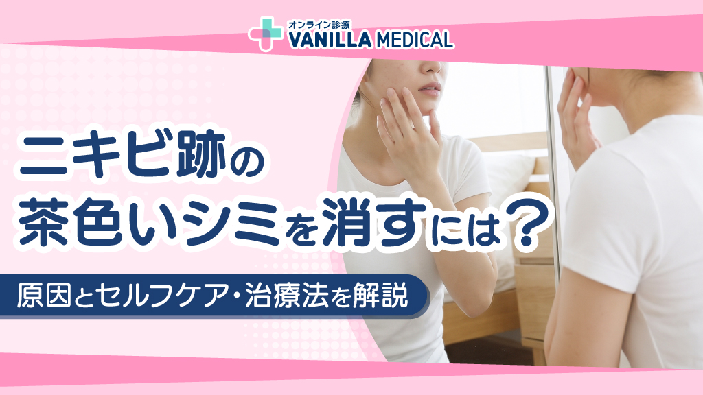 ニキビ跡の茶色いシミを消すには？原因とセルフケア・治療法を解説